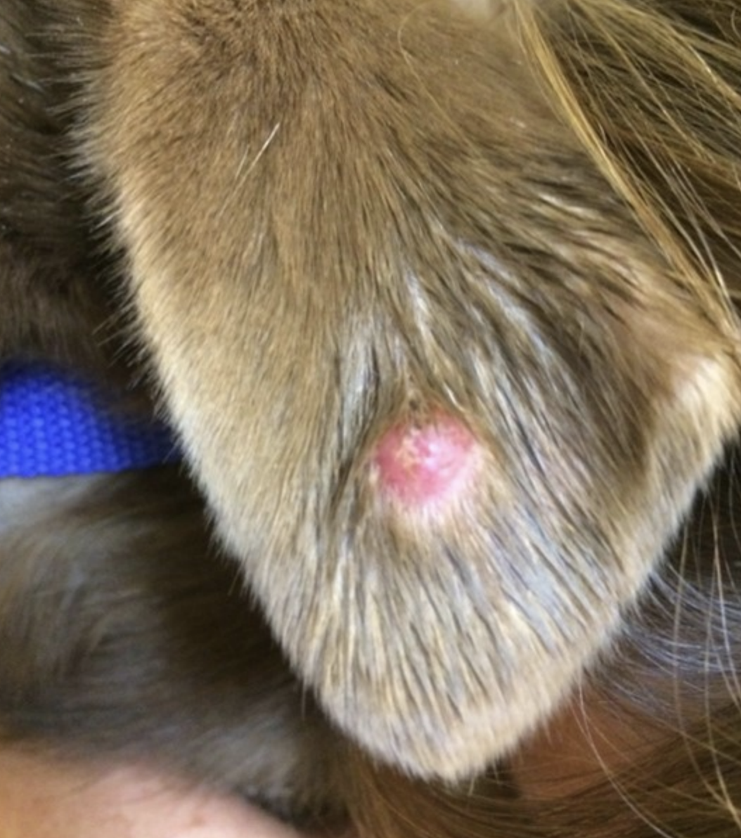 <p>often spontaneously regress within 1-2 months</p><p>-surgical resection if they dont go away on their own</p><p>-cryosurgery</p>