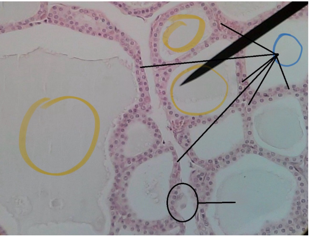 <p>Calcitonin</p>