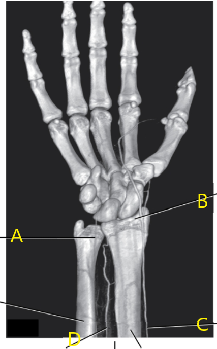 <p>What is letter A arrow pointing to ?</p>