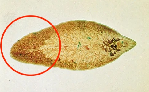 <p>What end is displayed of the sheep liver fluke?</p>