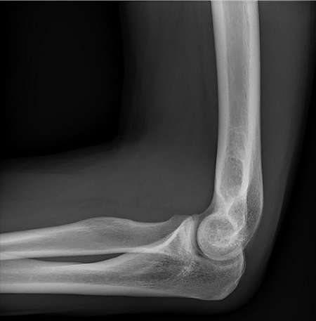 <p>What type of joint bends and straightens?</p>
