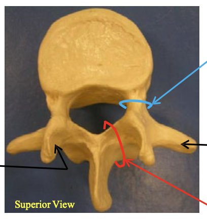 <p>Name the group of vertebrae this one would belong to.</p>