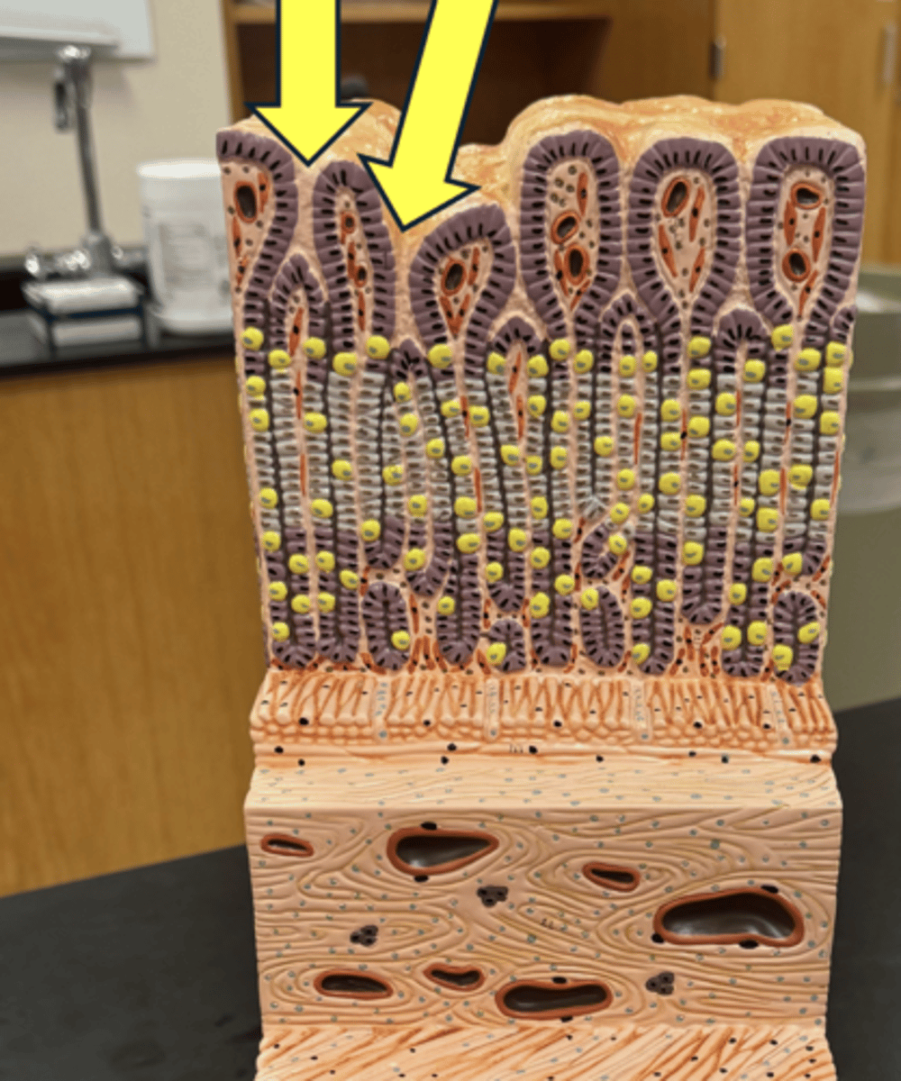 knowt flashcard image