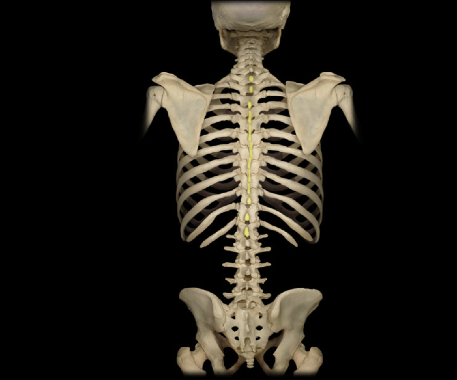 <p>Spinous process of thoracic vertebra</p>
