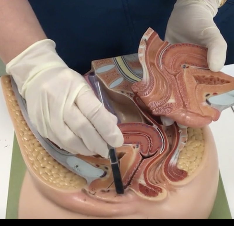 <p>Description: Inferior opening of the vagina</p><p>Relationship: Covered by the hymen</p>