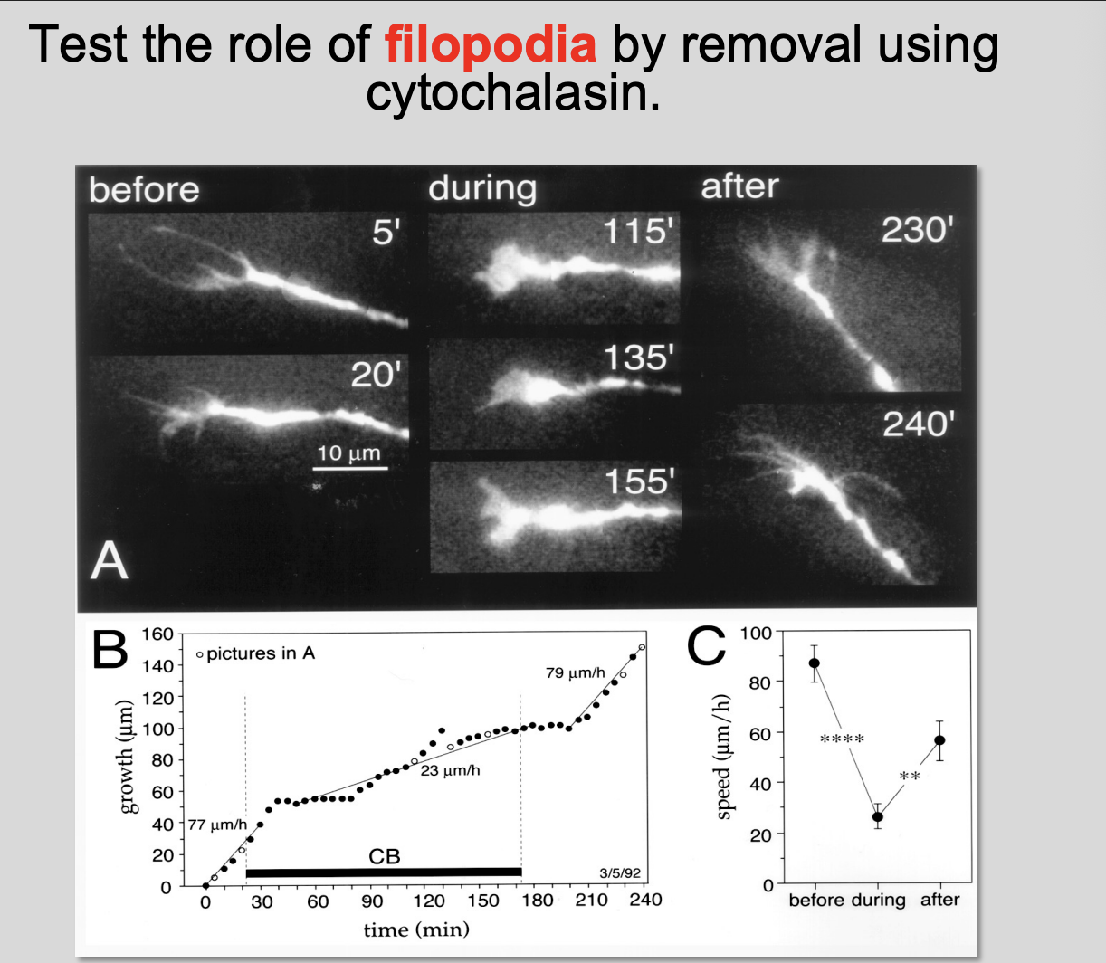 <p>Testing the role of filopodia in the turning</p>