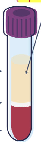 <p>Name the portions of this plasma tube from top to bottom.</p>