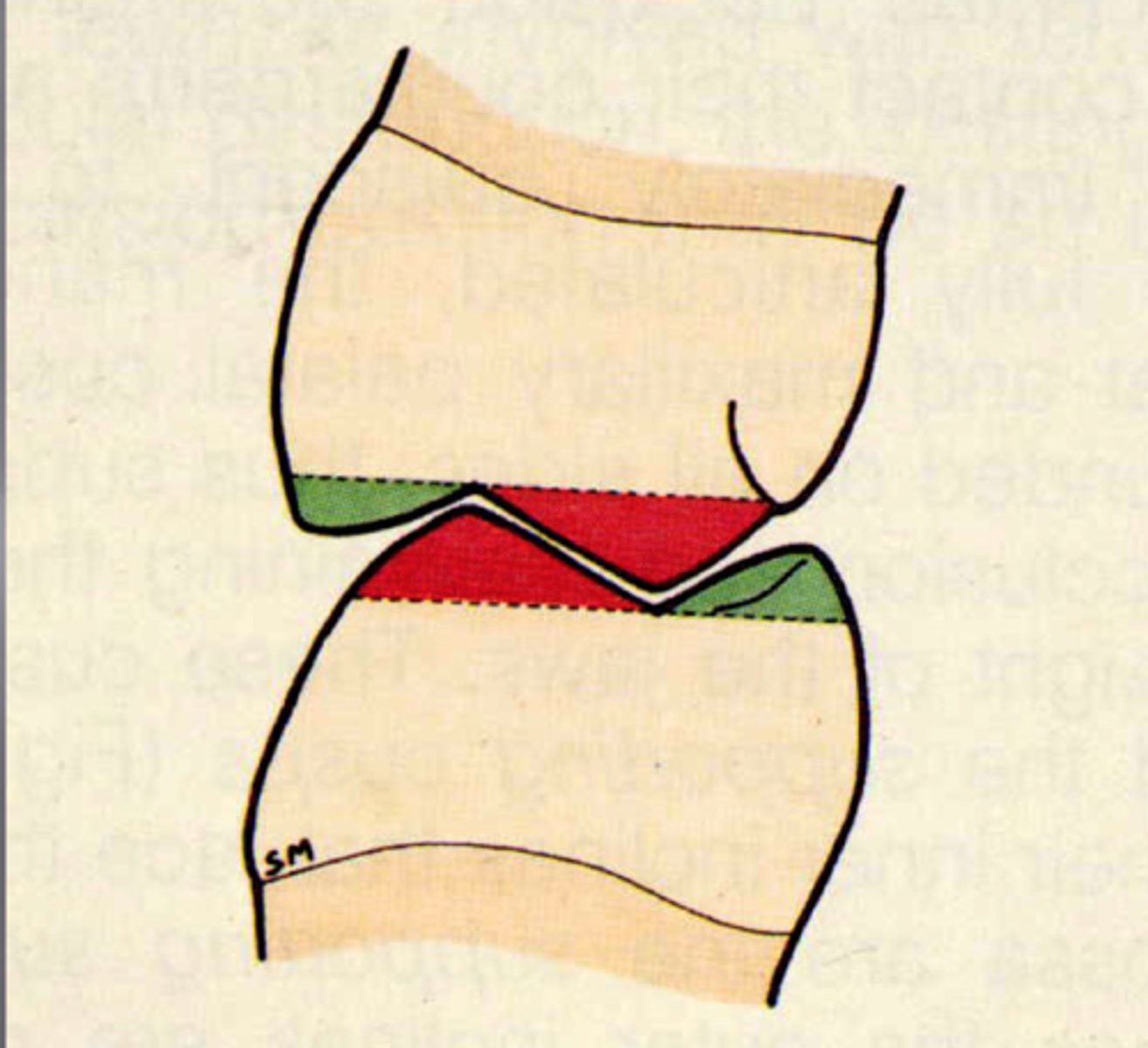 <p>-appearance: sharper with defined cusp ridges and tips</p><p>-function: mandible stability in occlusion</p><p>(Picture: green = non-centric/non-working cusps)</p>
