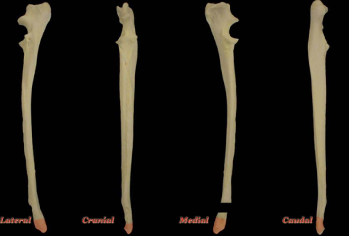 <p>What structure is highlighted in this picture?</p>