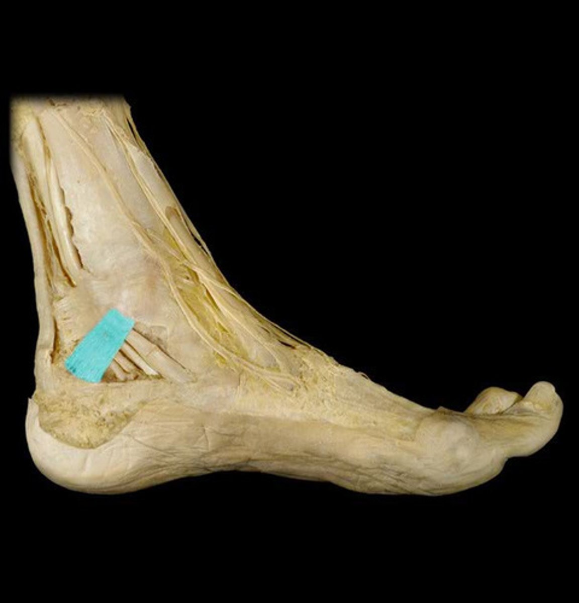 <p>located on the side of the foot</p>