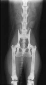 <p>Osteosclerosis</p>