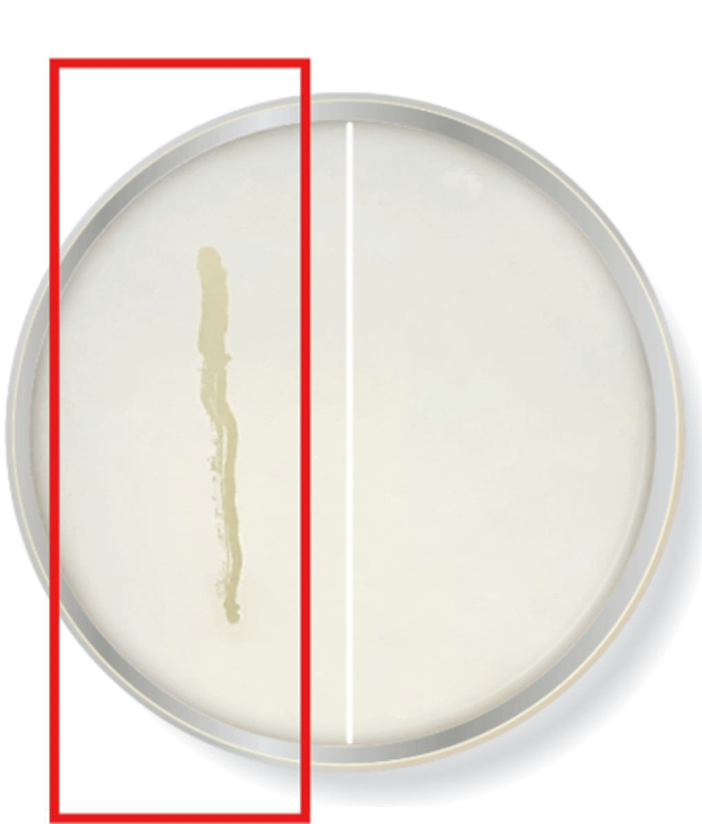 <p>this is a common halotolerant bacteria</p>