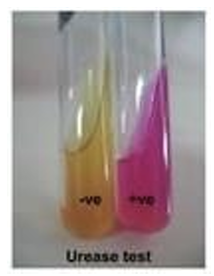 <p>• Some bacteria produce the enzyme urease, which breaks down ureainto ammonia and carbon dioxide:</p><p> • The release of ammonia increases the pH, making the medium alkaline. </p><p></p><p>• The phenol red indicator in the medium changes color based on pH:</p><p> • pH &lt; 6.8(acidic) → Yellow </p><p>• pH &gt; 8.2(alkaline) → Bright Pink/Magenta</p>