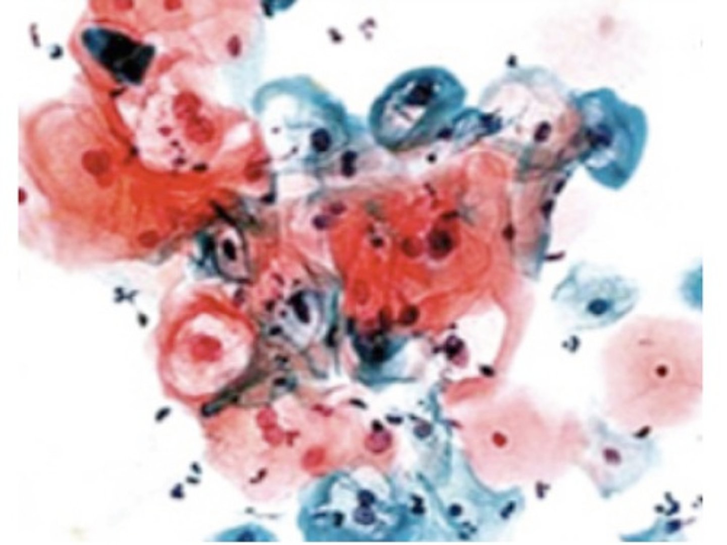 <p>A polychromatic stain is used to show nuclear detail. Blue/Purple: Nuclei (via Hematoxylin).</p><p>Pink/Green/Orange: Cytoplasm (showing how mature the cell is).</p>