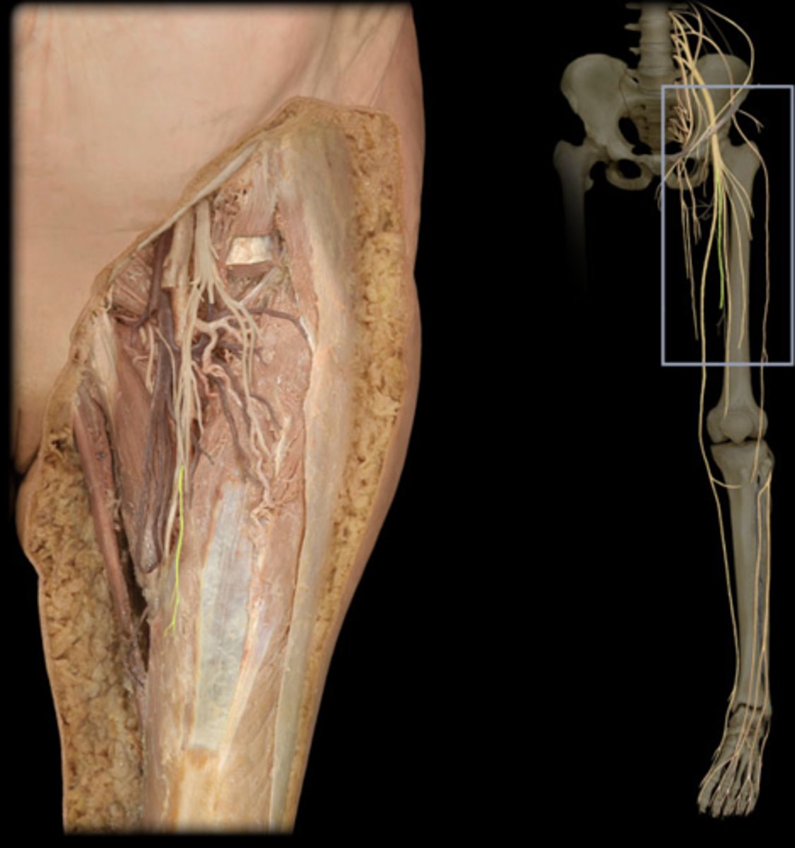<p>Femoral nerve (L2, L3, L4)</p>