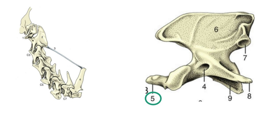 * C2 vertebra
* Very large and long dorsal spinous process
* Dens (*green 5*) – peg-like cranial process
* Where it articulates with the axis
* Pivot joint – (“no”)
* axis and atlas articulate at atlanto-axial joint