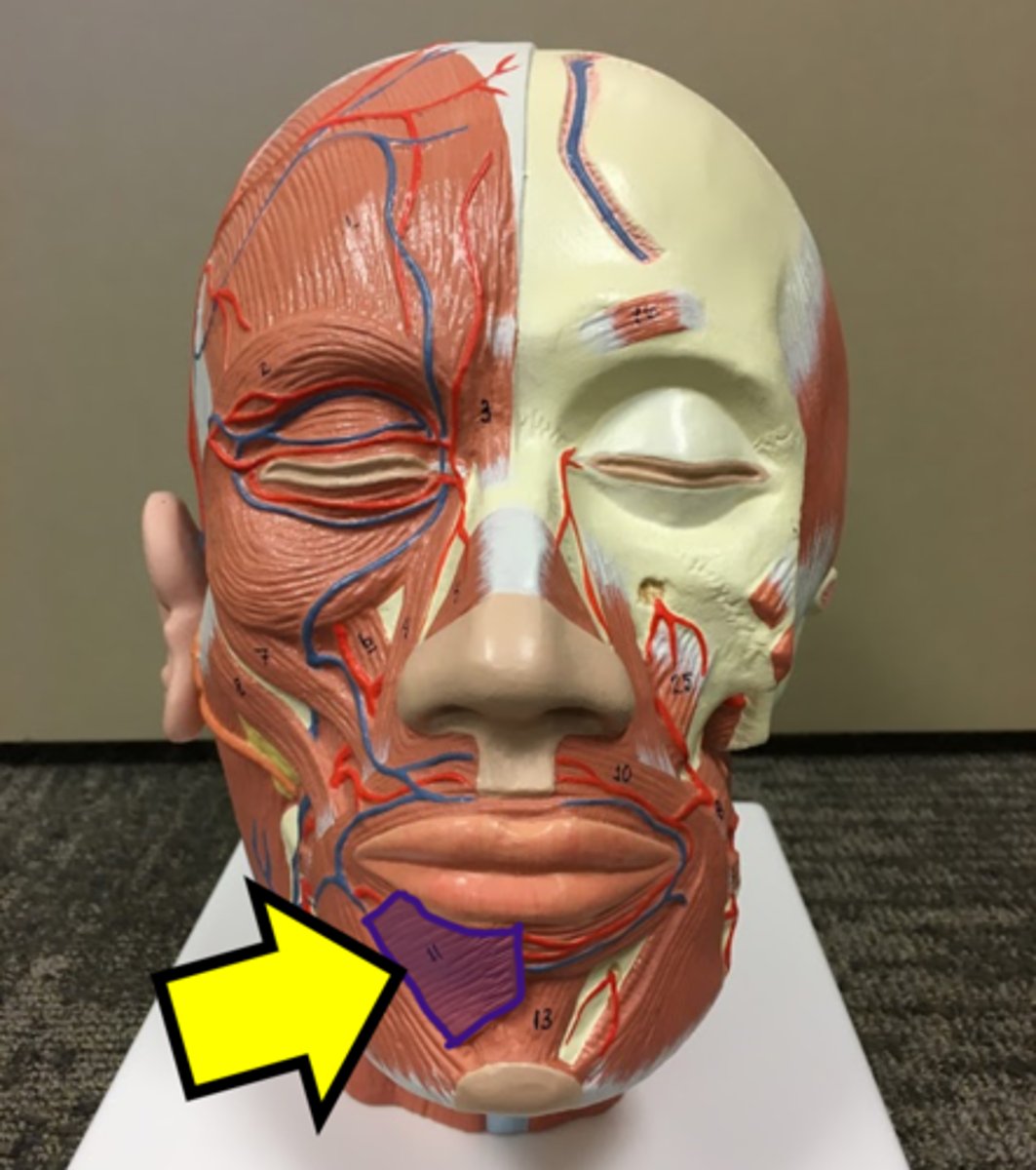 <p>Name the muscle</p>