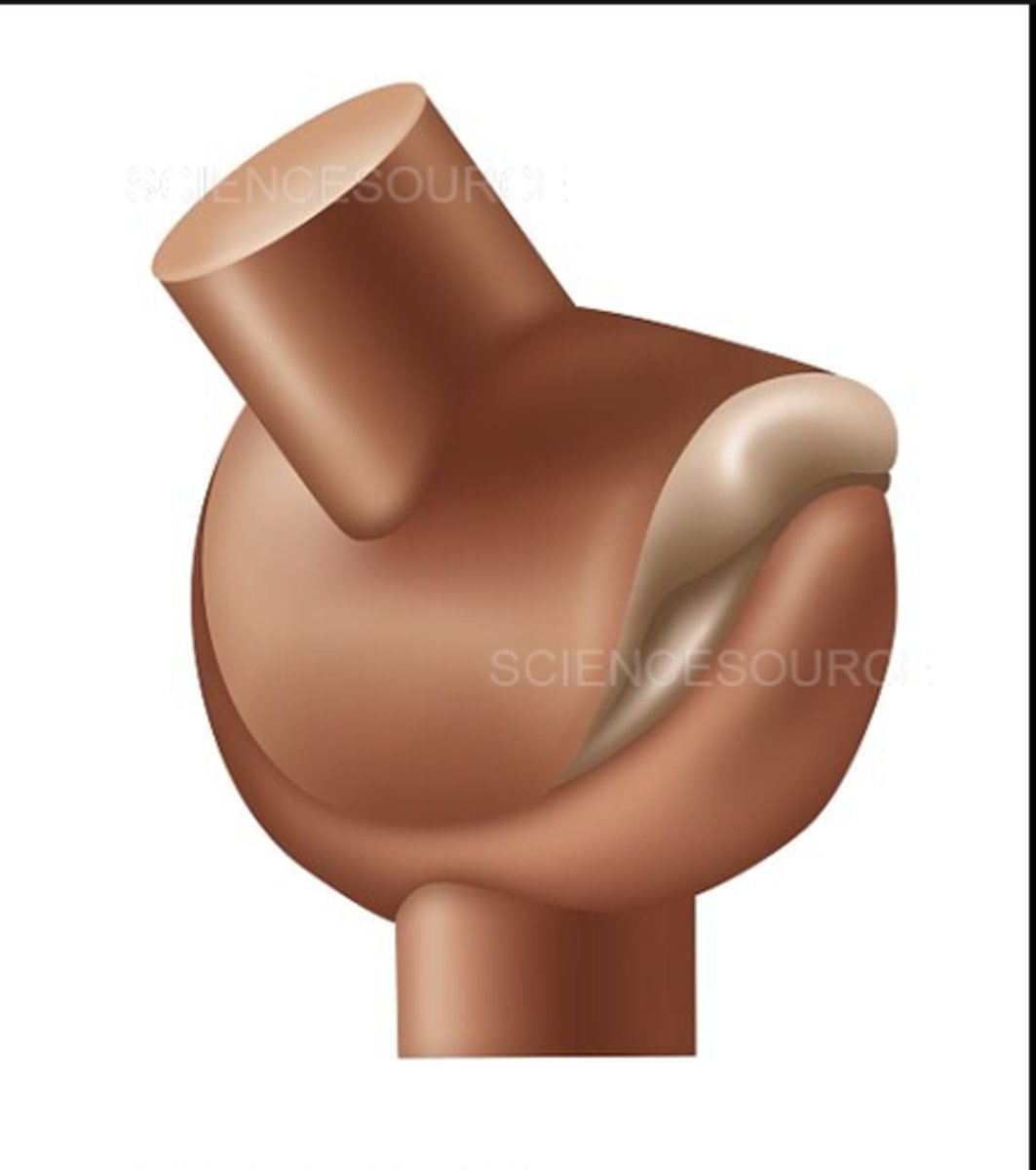 <p>type of joint found at the base of each thumb; allows grasping and rotation</p>