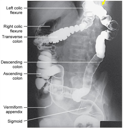 <p>Barium Enema: Identify the Position</p>