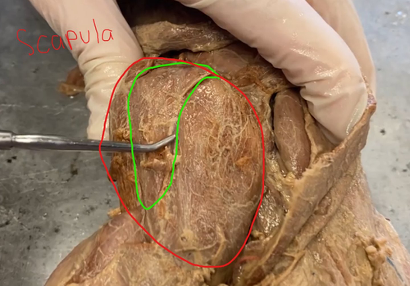 knowt flashcard image