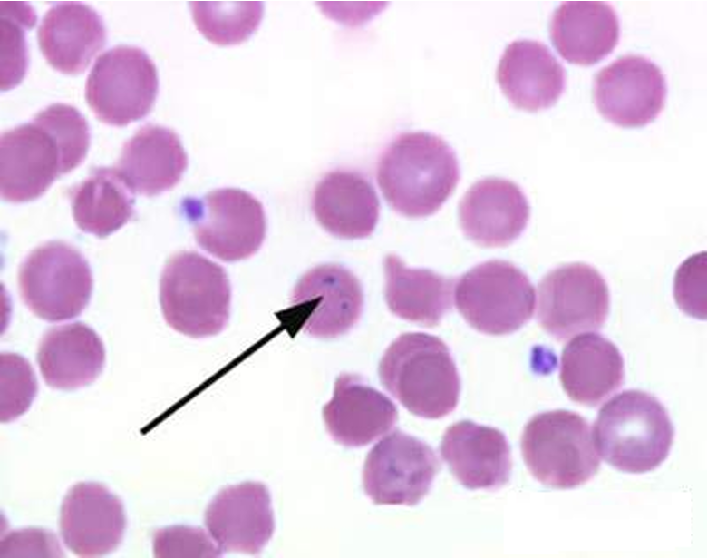 <p>Small, irregular <u>magenta-colored granule</u>s that usually occur in <u>small groups</u></p><p>Derived from <strong>hemosiderin granules</strong> (non-heme iron deposits)</p>