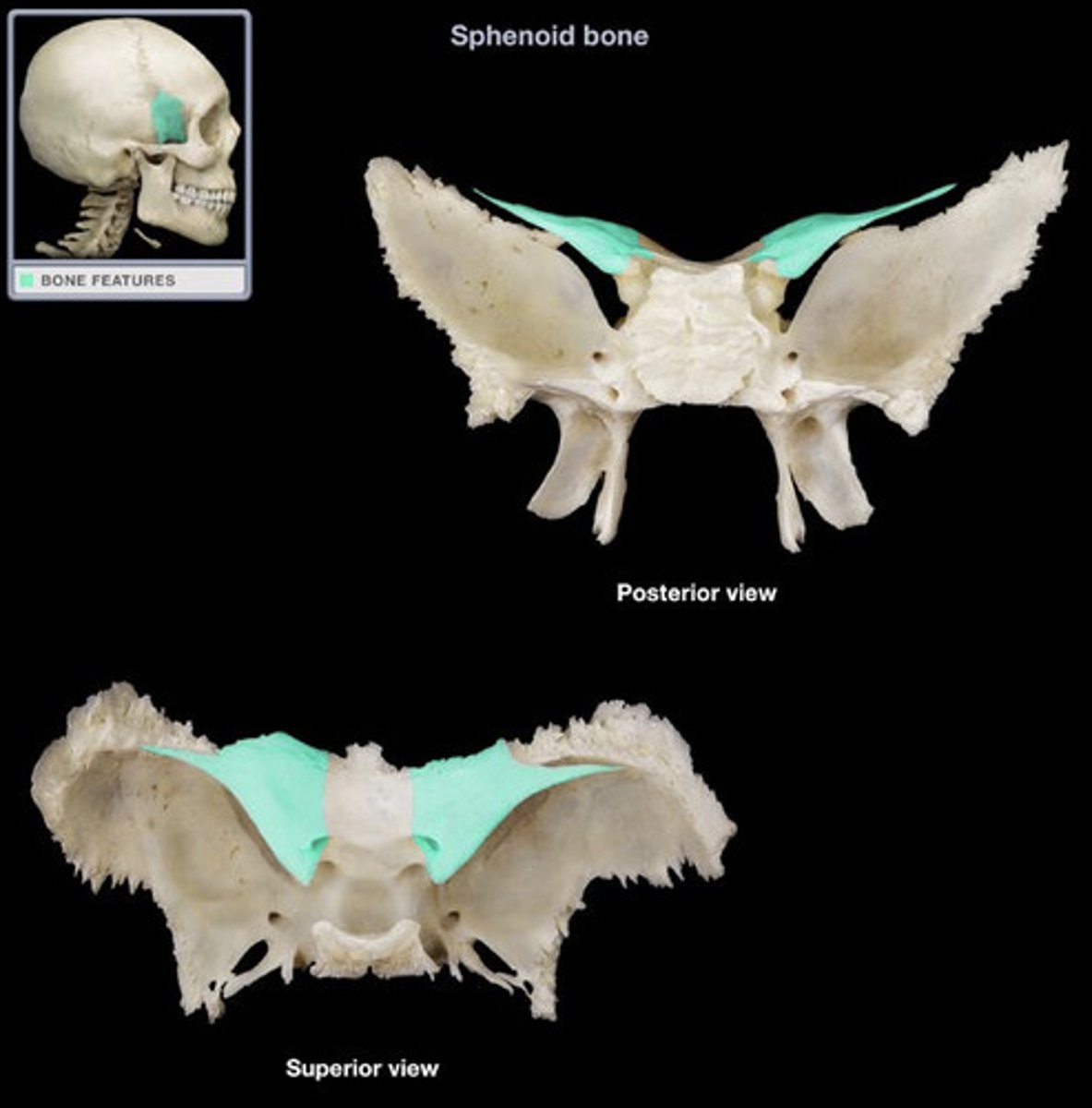 <p>sphenoid bone</p>