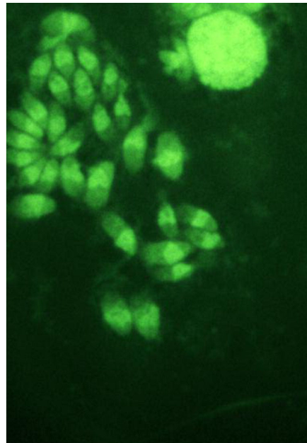 <p>this picture showing tachyzoites in cattle tissue by IFA is a result of what coccidia species?</p>