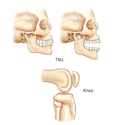 <p>2 condyles on top of each other</p>