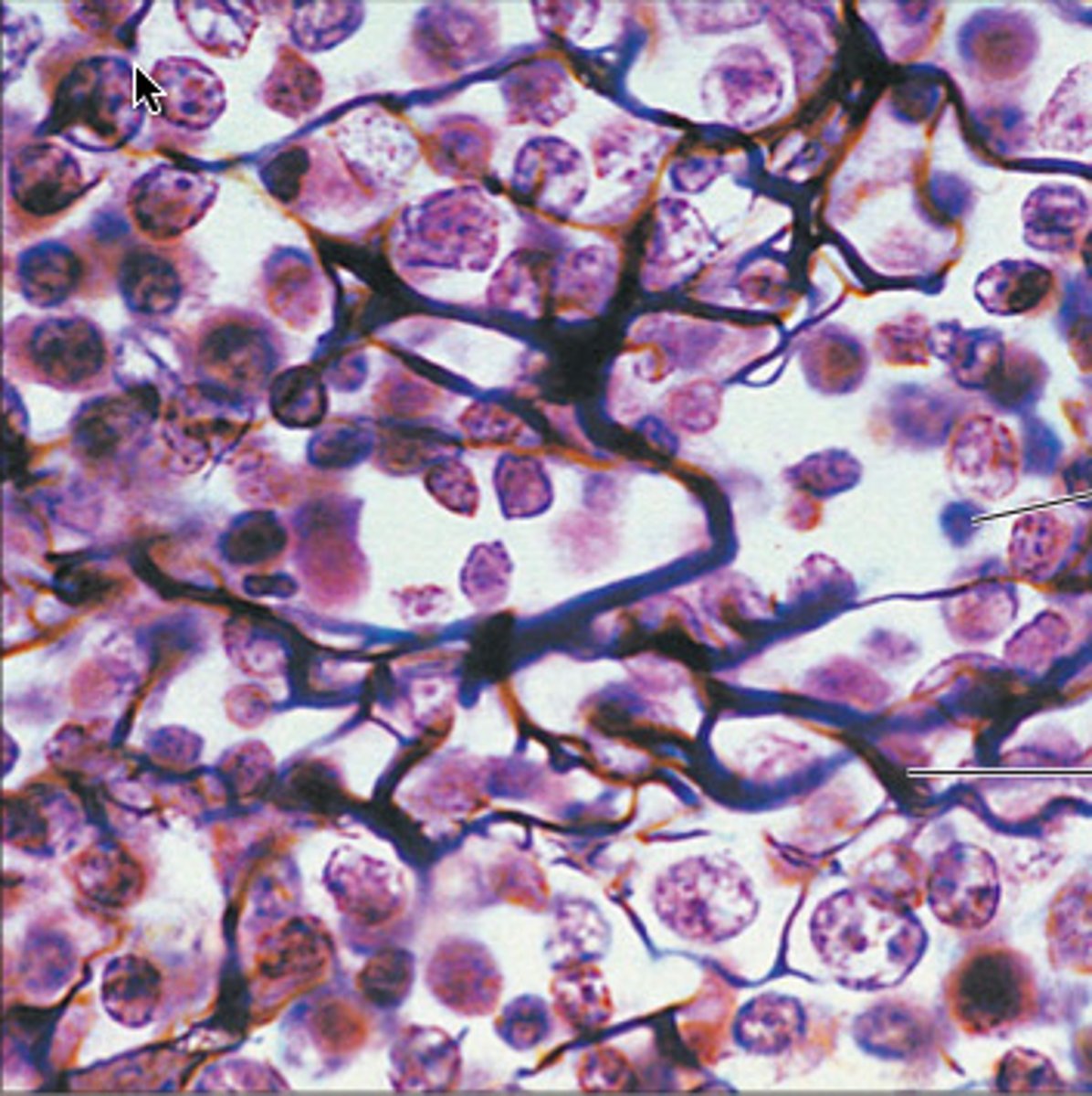 <p>Located in bone marrow, spleen, and liver.</p><p>Function is removes worn out RBCs in spleen and support.</p><p>Hint: looks like chicken wire.</p>