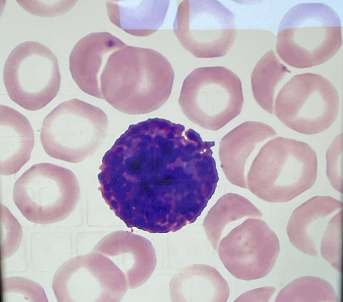 <p>Identify this leukocyte and state what color it stains</p>