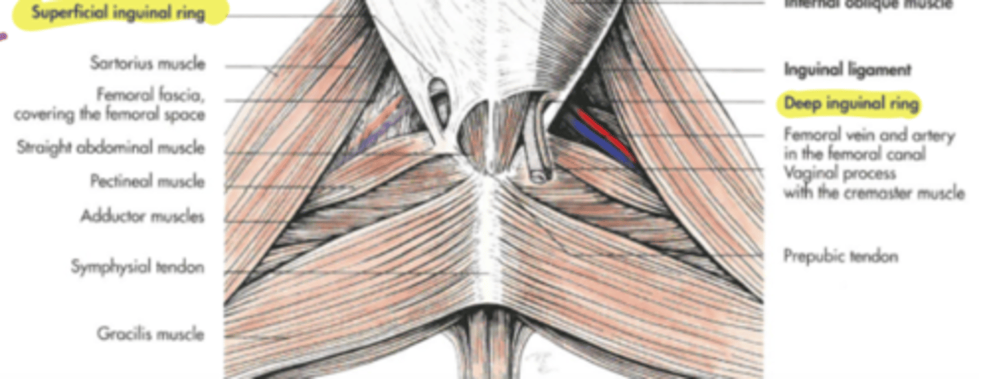 <p>canals that allows intraabdominal structures to move from the inside to outside. In the female ( part of uterus) and the male (spermatid cordes )</p>