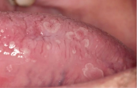 <p>what is the diagnosis </p>