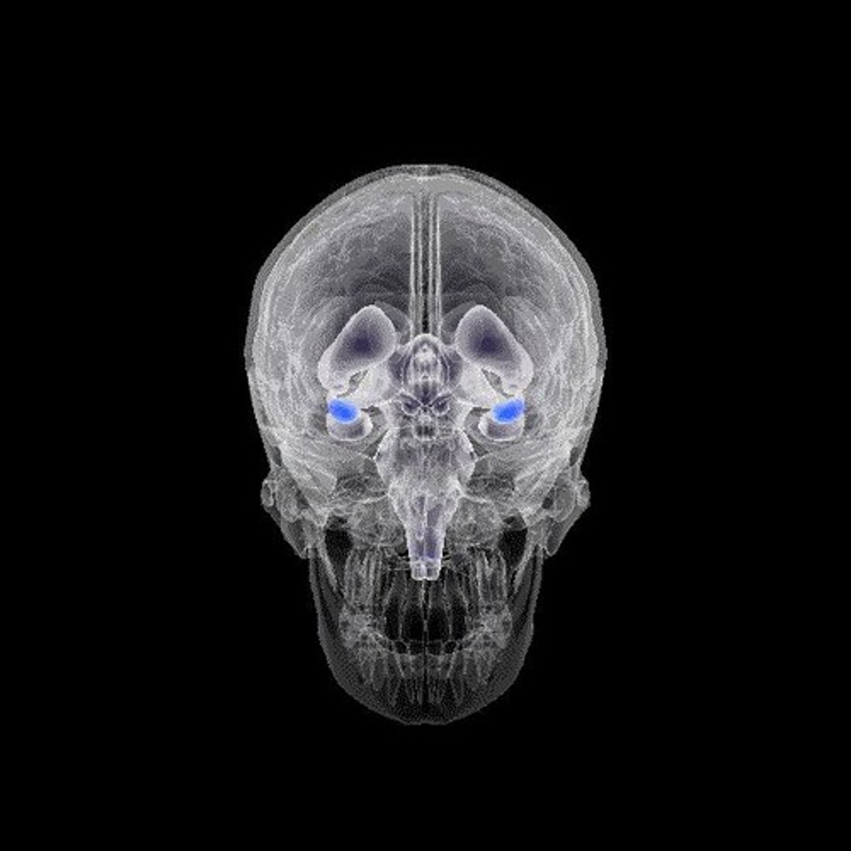 <p>The amygdala is the emotional center of the brain; increased activity in this area is associated with impulsiveness and aggression in violent criminals.</p>