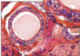 <p>tall slender cells</p><p>nuclei at various levels, some cells don’t extend to apical surface</p><p>location: parotid gland duct lining</p><p>function: absorption and secretion</p><img src="https://knowt-user-attachments.s3.amazonaws.com/8d526dd6-6022-45f8-b7f1-6adb1536194f.png" data-width="100%" data-align="center"><p></p>