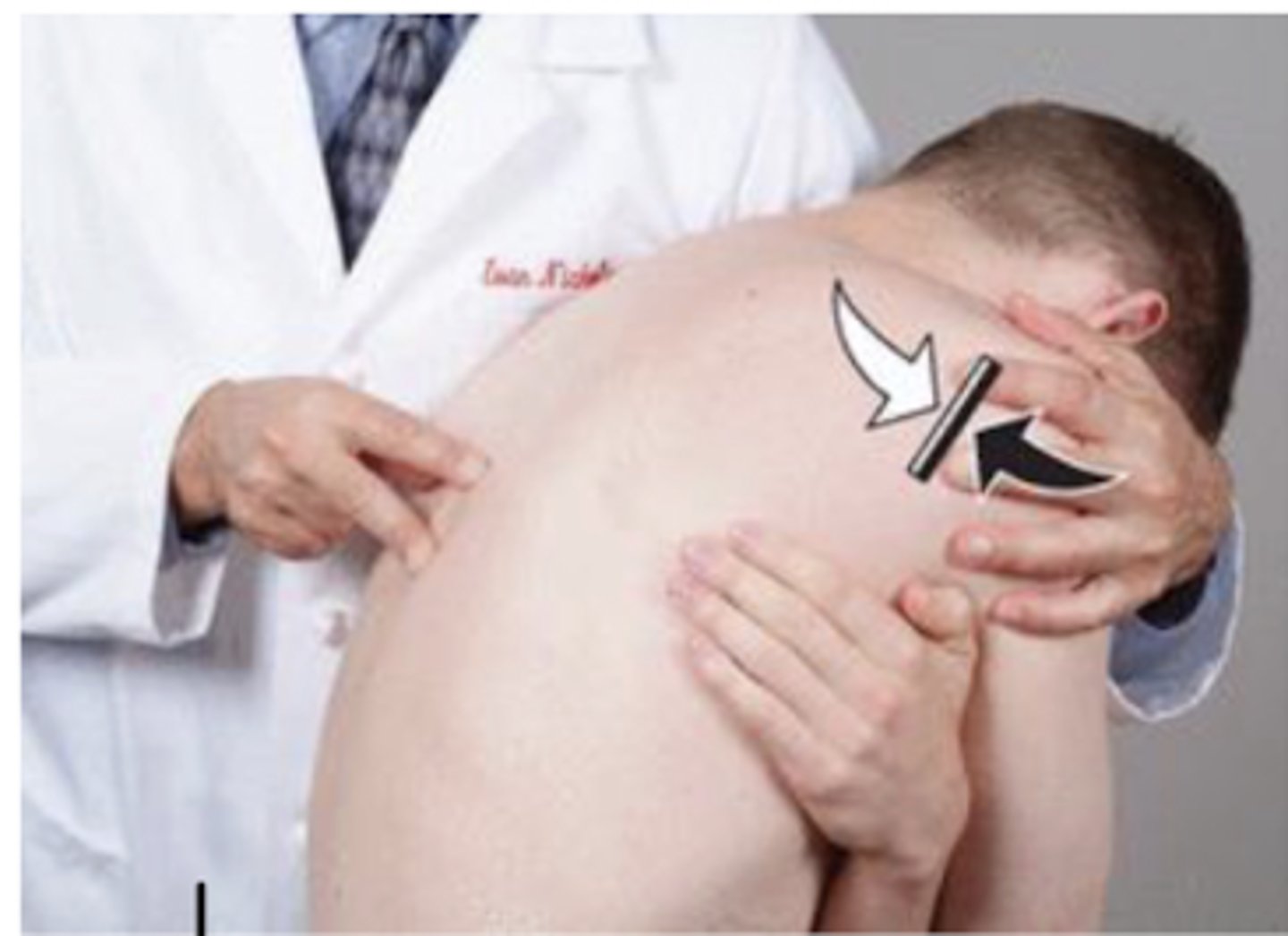 <p>osteopathic hug</p><p>physician stand on OPPOSITE side of rotational component</p><p>direct: moving pt INTO barrier in ALL PLANES (F/E R S)</p><p>active: pt moves back toward direction of freedom in one plane</p>