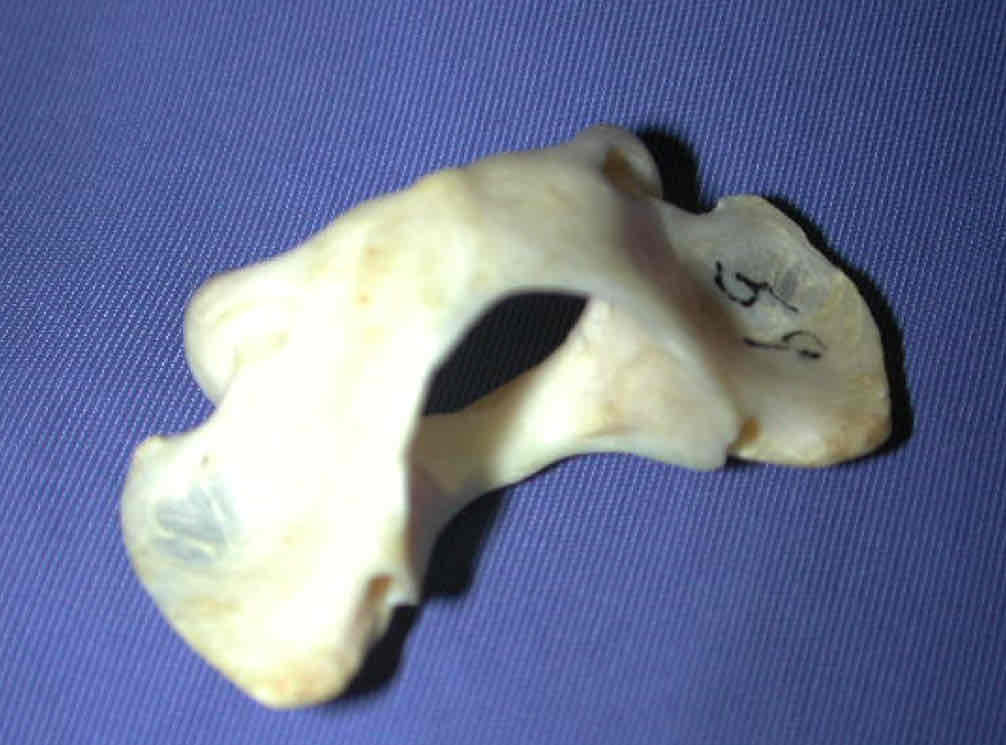 <p>What vertebra is this? How can you tell?</p>