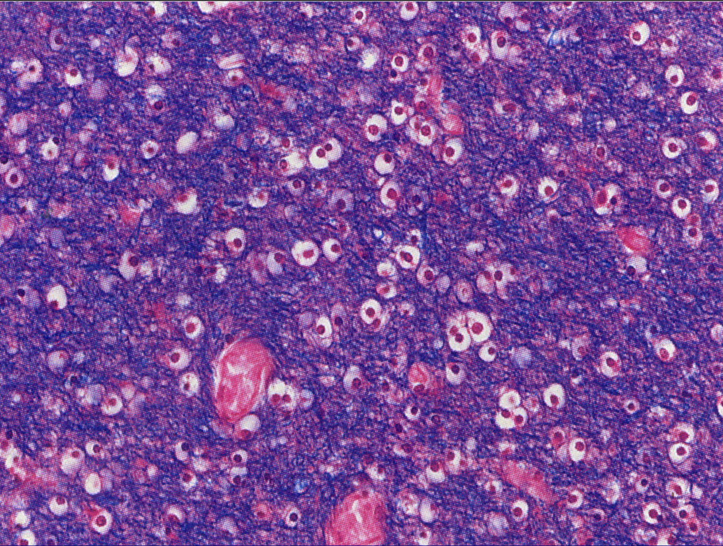 term image