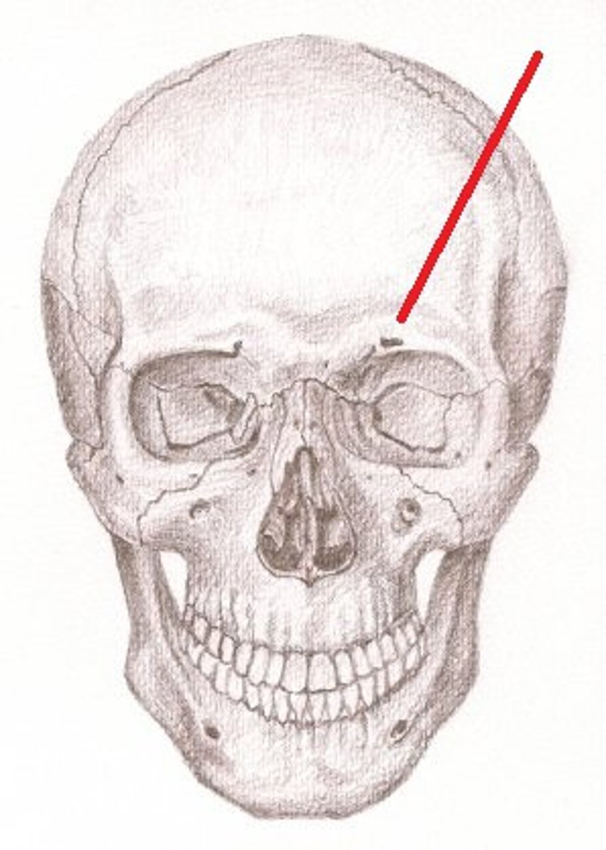 <p>a bony ridge above the eye sockets. It is found in all primates, but is greatly reduced in Homo sapiens</p>