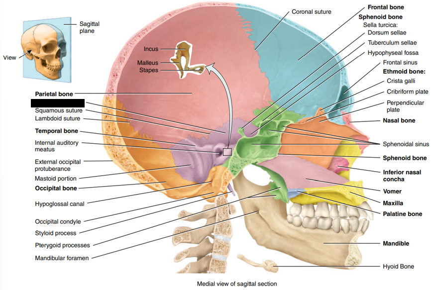 <p>State and identify what part of the cranial bone is being pointed out and censored. (hint: Squama)</p>