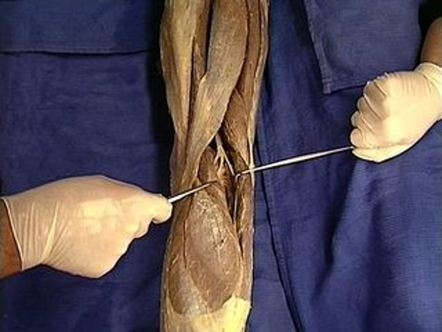 <p>the muscle in the back part of the leg that forms the greater part of the calf; the outer most part</p>