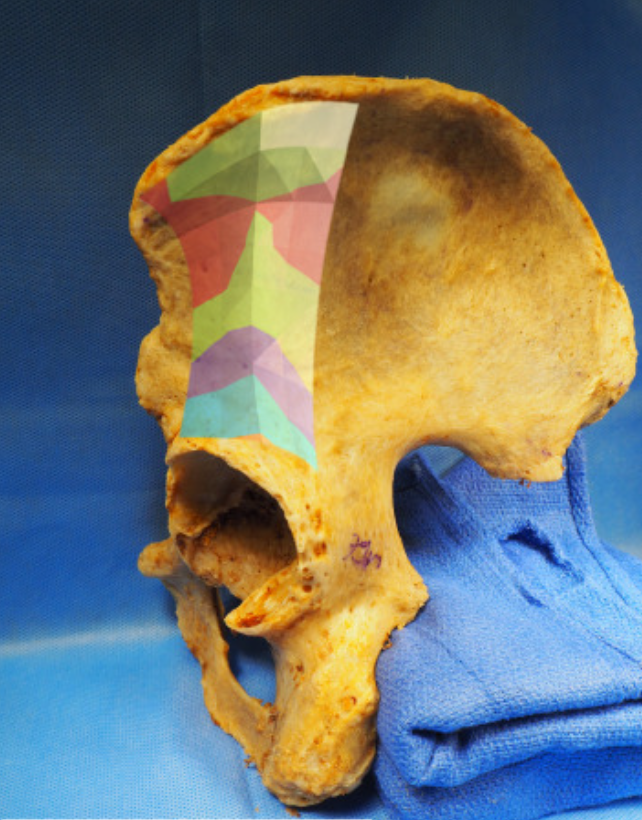 <p>The multi-colored section is?</p>