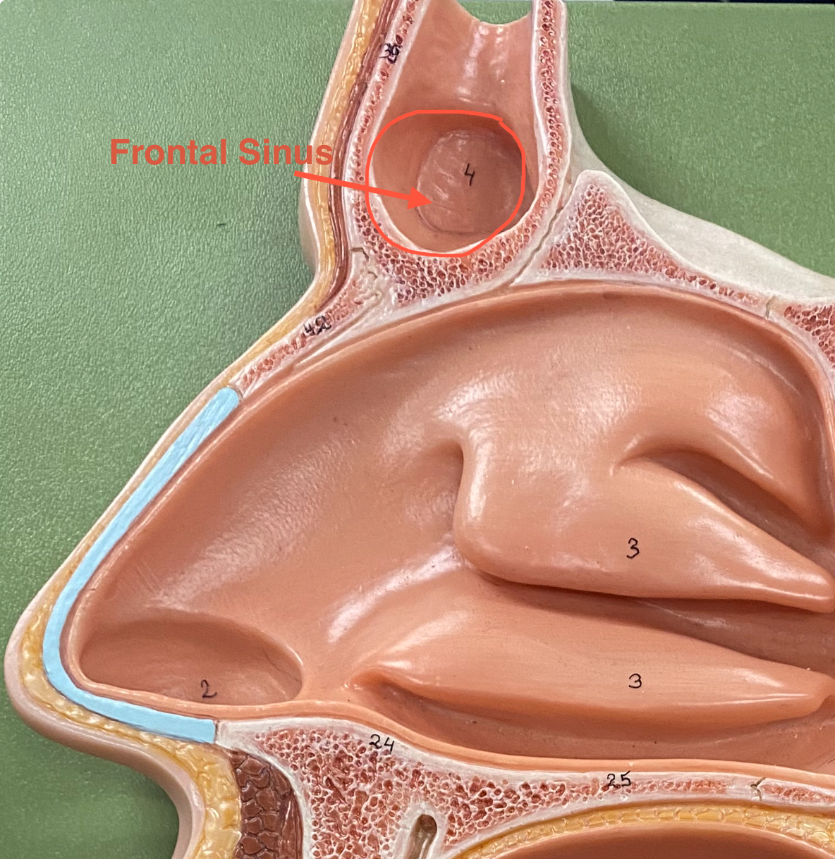 <p>It appears as a hollow, air-filled cavity that opens into the nasal cavity and helps lighten the skull, produce mucus, and enhance voice resonance.</p>