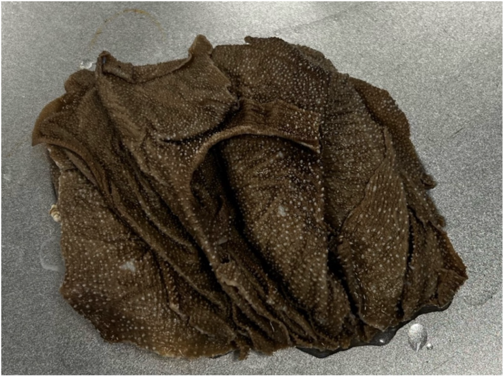 <p>What compartment of the ruminant stomach is this tissue from? </p>