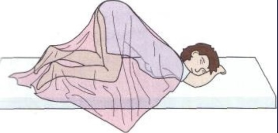 <p><span>Knee-chest (genupectoral)</span></p>