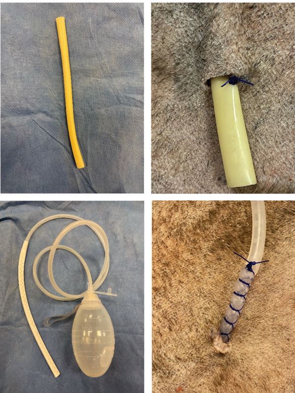 <p>tube or wick used to draw fluid from body cavity to surface</p>