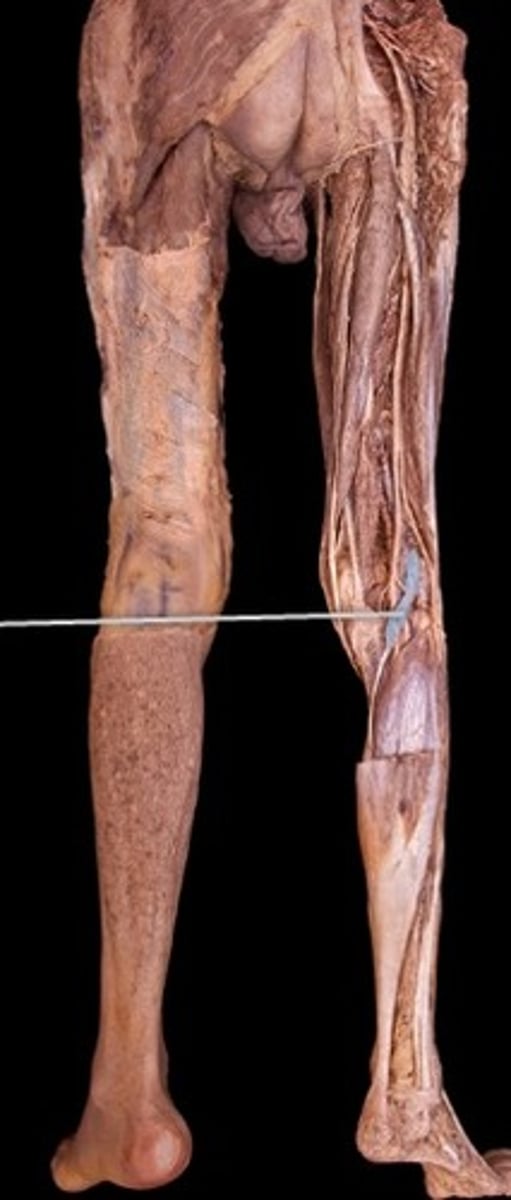 <p>What muscle is this?</p>