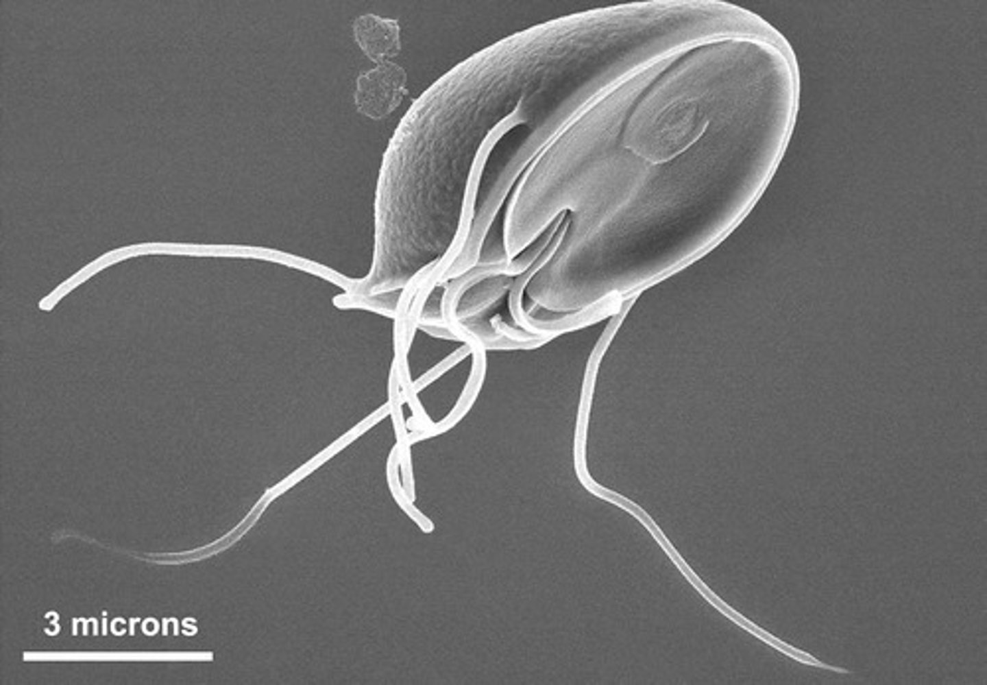 <p>Giardiasis.</p>