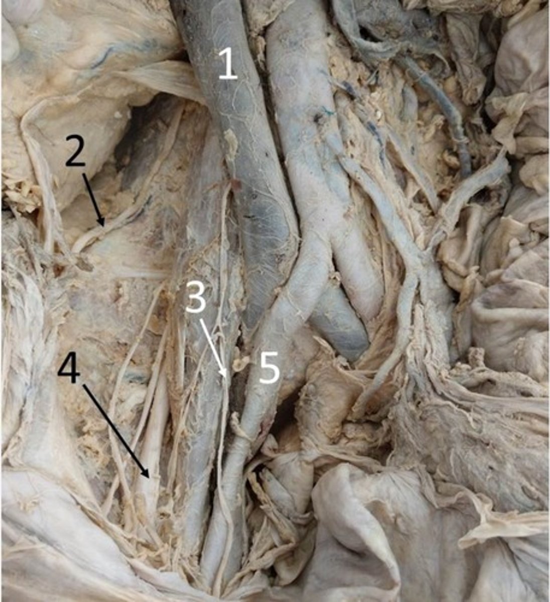 <p>ID 5</p>