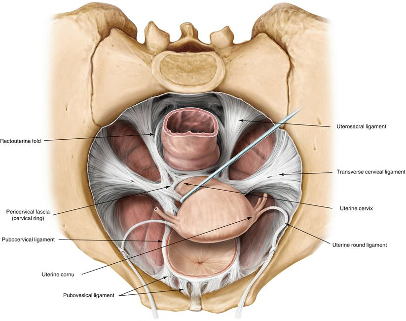 <p>A méhnyakat erős kötőszövetes szalag horgonyozza ki a medence oldalfalához: a lig cardinale (a képen transverse cervical ligament, de parametrumként is emlegetik).</p><p>Ezen a kötőszövetes rendszeren keresztül érkezik meg a méhhez fő tápláló artériája az a. uterina is. De a méhnyakrák terjedésében is kiemelt jelentőségű útvonal!</p>