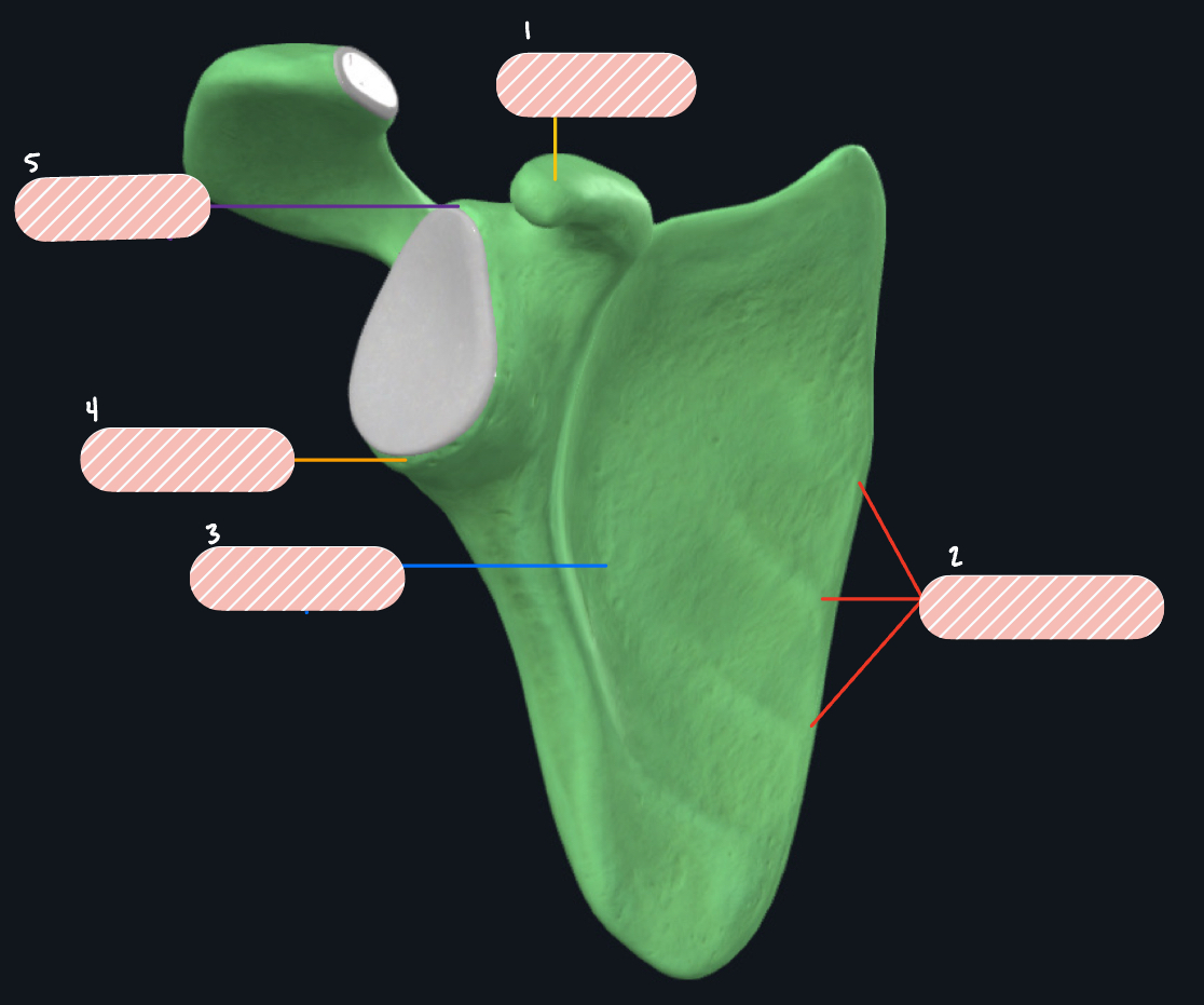 <p>What bone is this?</p>